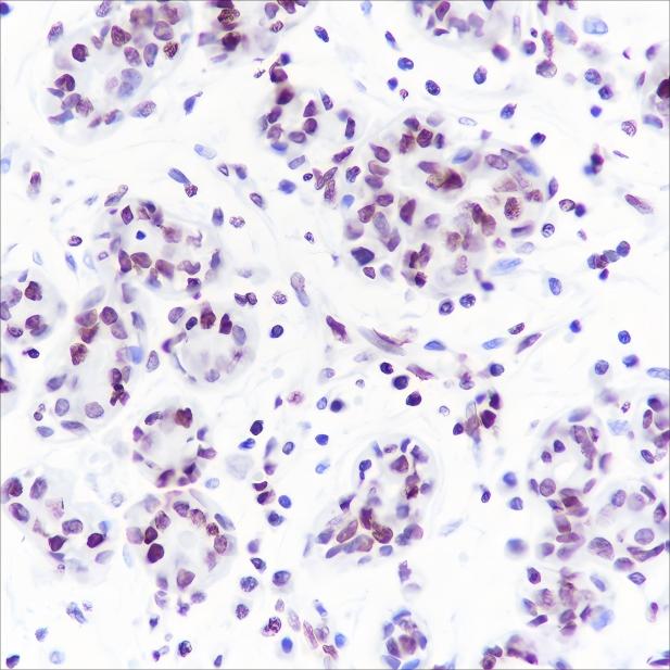 Recombinant Histone H1 (CT) Monoclonal Antibody - 2