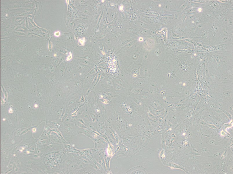 MKN-7 [MKN7; MKN 7] Cell Complete Medium - 3