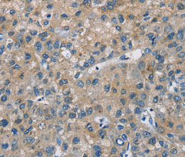 CAB39L Polyclonal Antibody - 2