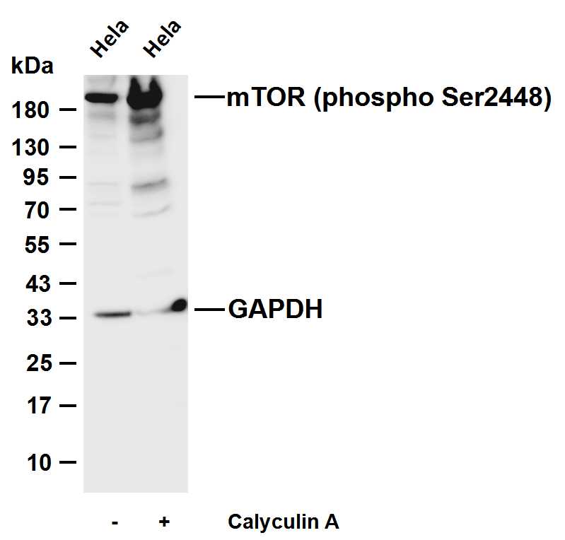 Recombinant Phospho-mTOR (Ser2448) Monoclonal Antibody - 3
