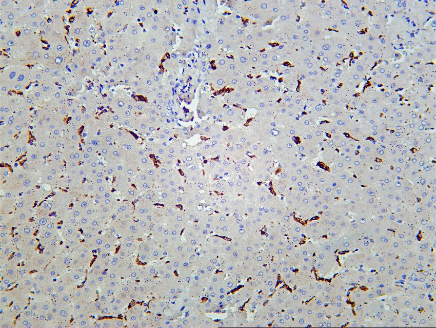 Recombinant CD68 Monoclonal Antibody - 3