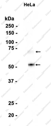 Recombinant Heparanase 1 Monoclonal Antibody - 1
