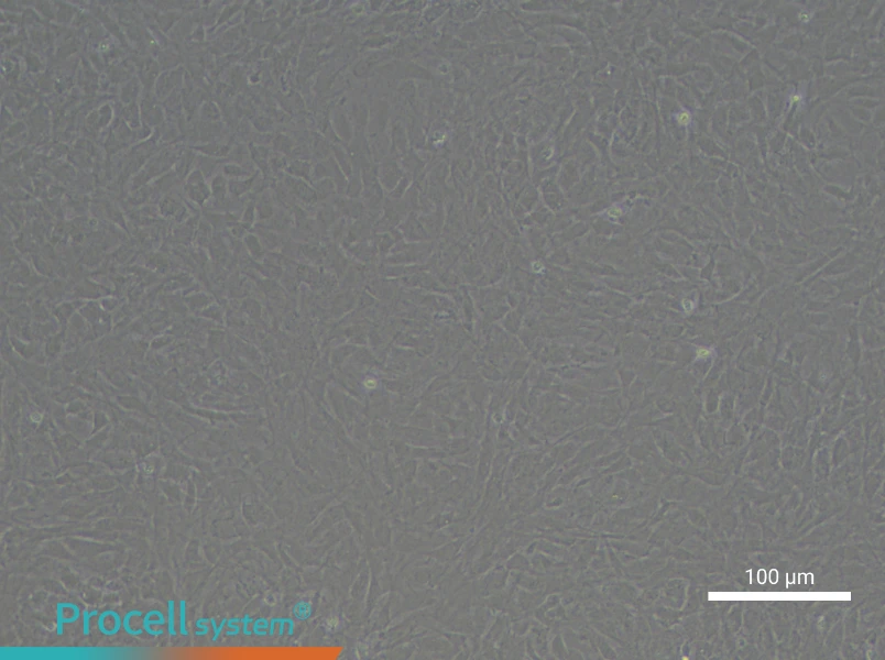 Rat Bronchial Fibroblast Complete Medium - 3