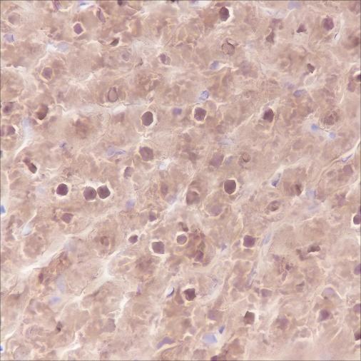 Recombinant SETBP1 Monoclonal Antibody - small - 5