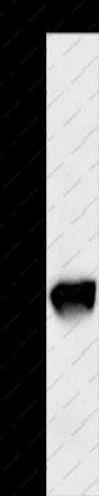 GSTO1 Polyclonal Antibody - 1