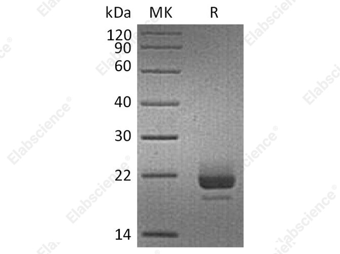 Recombinant Human CD40L/TNFSF5 Protein (His Tag) - 1