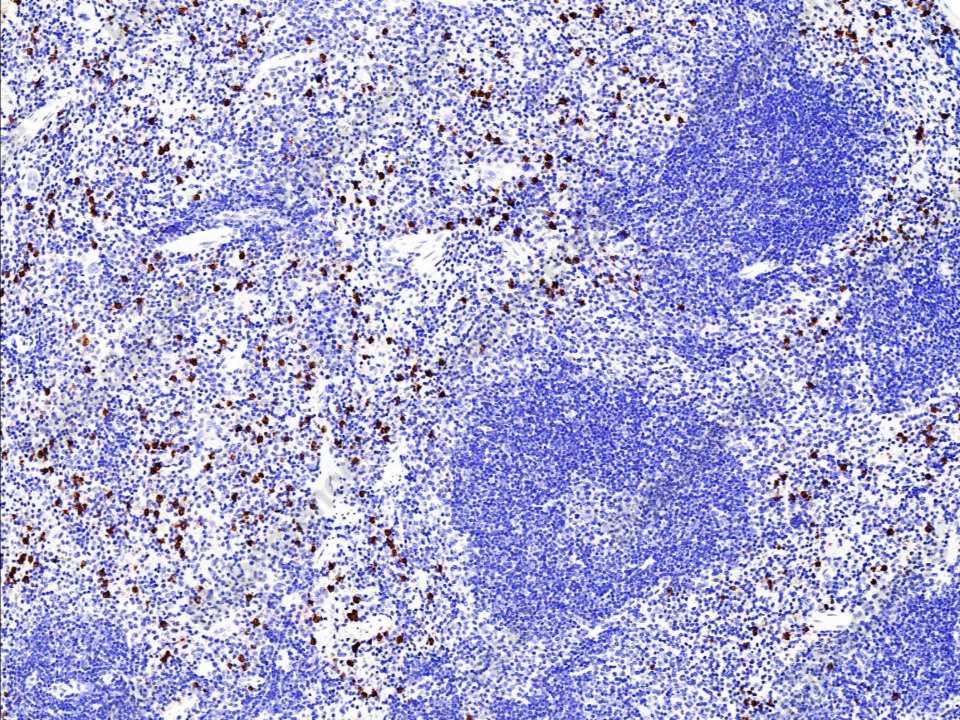 Recombinant S100A8 Monoclonal Antibody - 2
