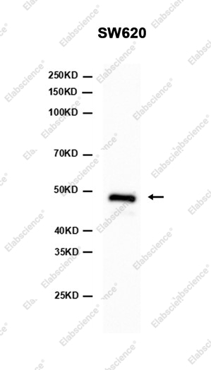 Recombinant Brachyury Monoclonal Antibody - 1