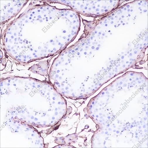 Recombinant DPEP1 Monoclonal Antibody - 2