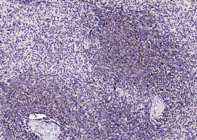 PD1/PDCD1/CD279 Monoclonal Antibody - 2