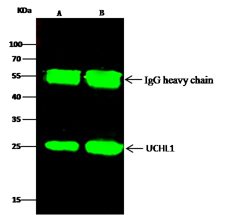 Recombinant UCHL1 Monoclonal Antibody - small - 2