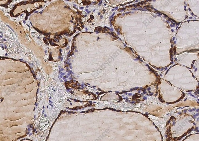 Thyroid peroxidase/TPO Monoclonal Antibody - 1