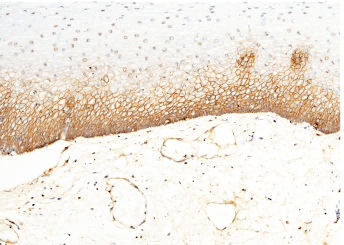 CD44 Monoclonal Antibody - small - 2