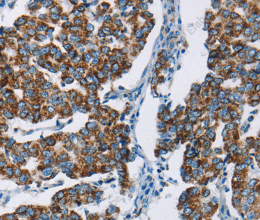 HINT2 Polyclonal Antibody - 2