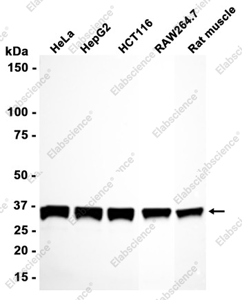 Recombinant PP2A alpha/beta Monoclonal Antibody - 2