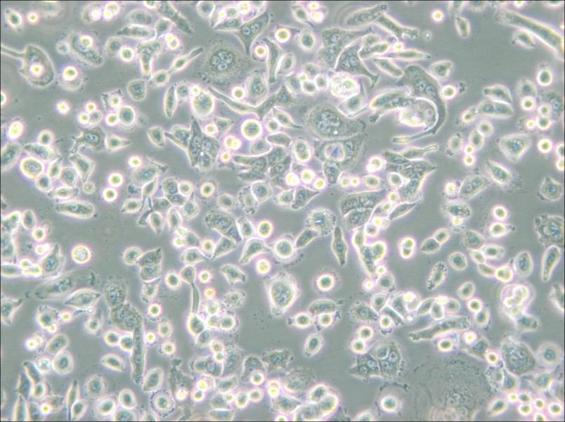 AsPC-1 Cell Complete Medium - 5