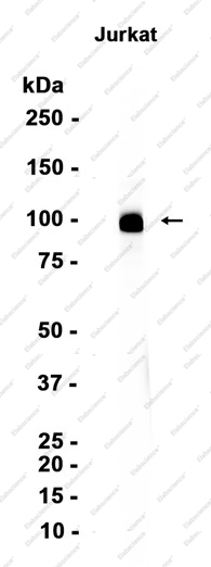 Recombinant CD6/T12 Monoclonal Antibody - 1