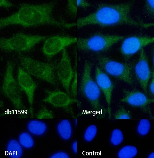 Recombinant 4E-BP1/EIF4EBP1 Monoclonal Antibody - small - 4