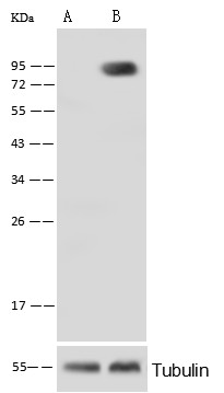 Recombinant Alkaline Phosphatase/ALPL Monoclonal Antibody - small - 2