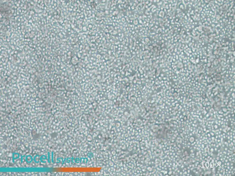 SU-DHL-2 Cell Complete MediumSU-DHL-2 Cell Complete Medium - 3