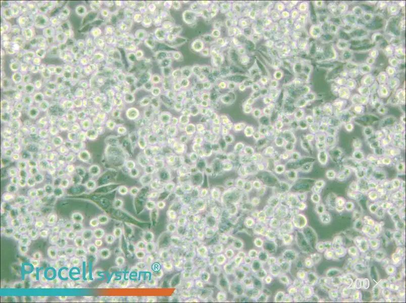 MIA PaCa-2 Cell Complete Medium - small - 5