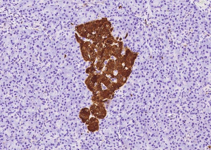 ENO2 Monoclonal Antibody-searchlist-1