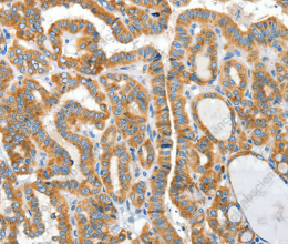 CKAP4 Polyclonal Antibody - 3