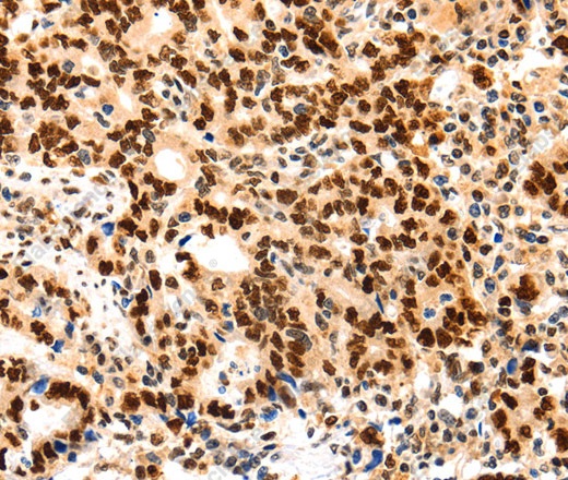 PCNA Polyclonal Antibody - 1