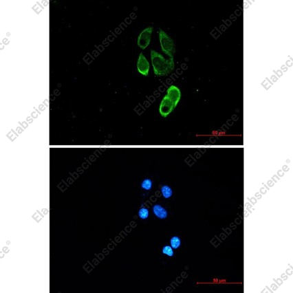 Recombinant TRIM25 Monoclonal Antibody - 2