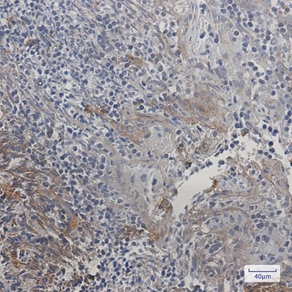 Recombinant SMAC/Diablo Monoclonal Antibody - 3