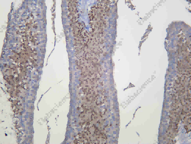 Recombinant USP11 Monoclonal Antibody - 1