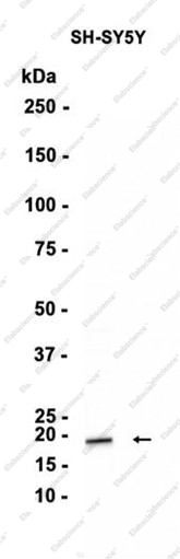 Recombinant Midkine Monoclonal Antibody - 1