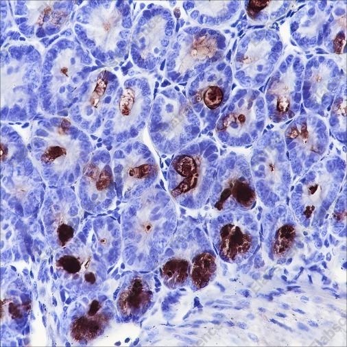 Recombinant MPTX Monoclonal Antibody - 2
