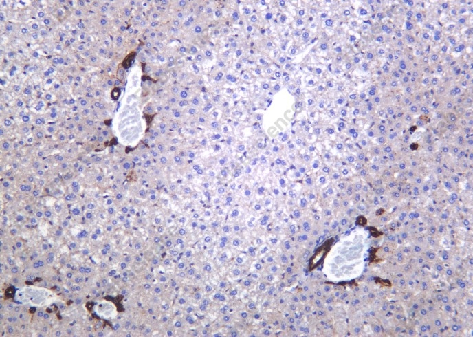 Recombinant LDLR Monoclonal Antibody - 1
