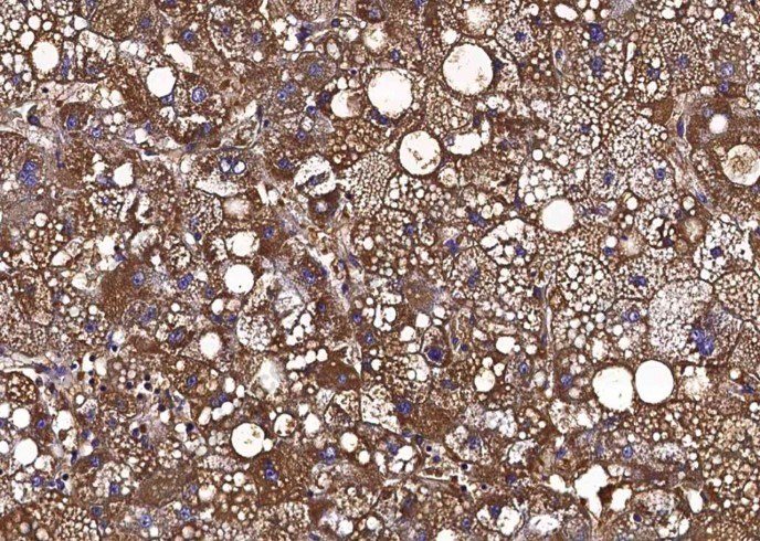 CD113/Nectin-3 Monoclonal Antibody - 2