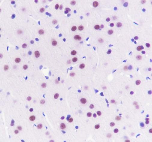 Recombinant TBLR1/TBL1XR1 Monoclonal Antibody - small - 3