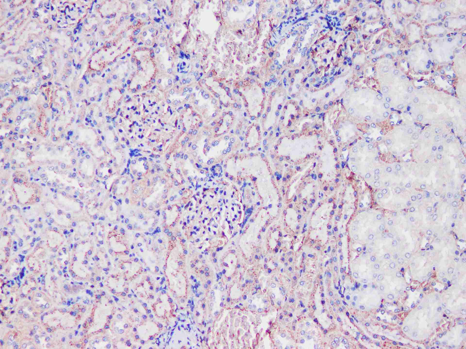 Tf Polyclonal Antibody - small - 4