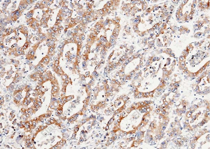 LRPAP1 Monoclonal Antibody - 2
