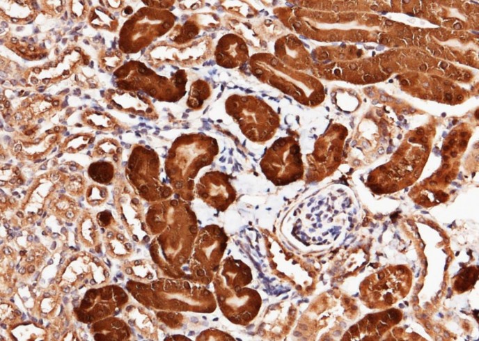 Recombinant CNDP2 Monoclonal Antibody-searchlist-1