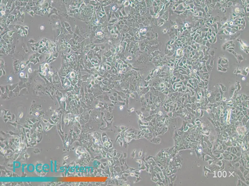 OV-90 Cell Complete Medium - 3