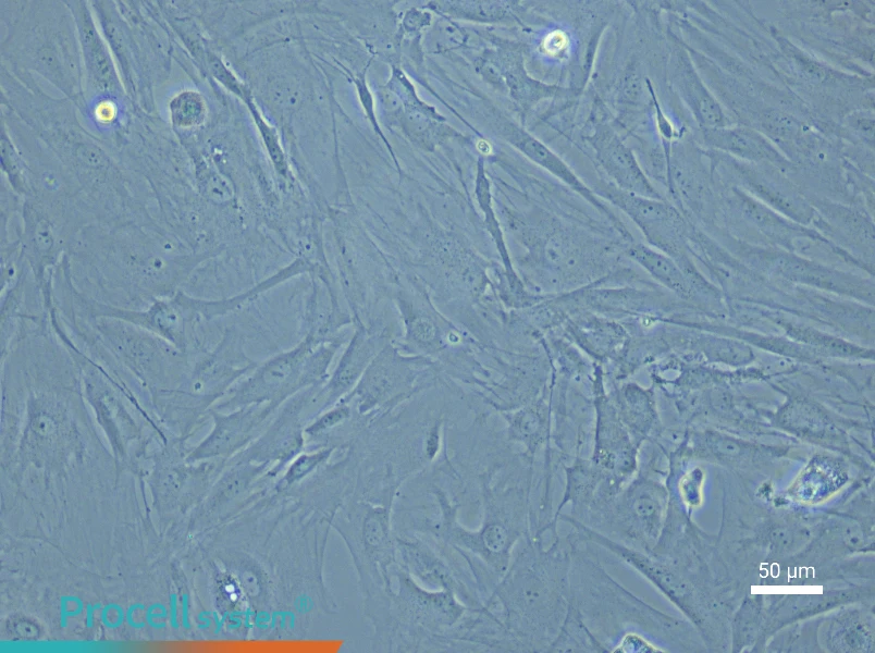 Mouse Brain Fibroblast Complete Medium - 6