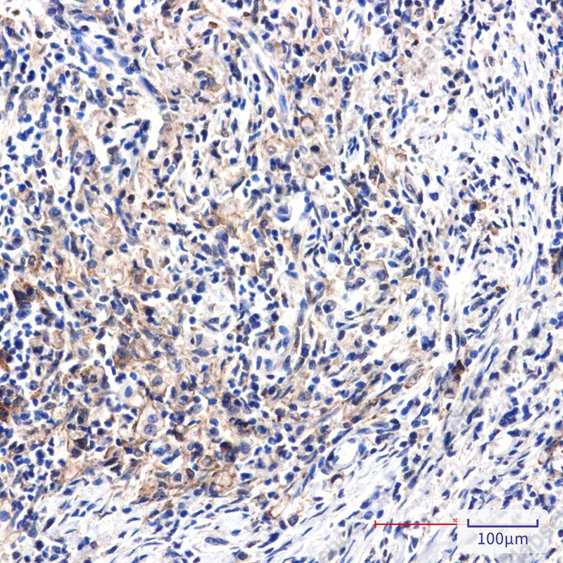 Recombinant DAB2 Monoclonal Antibody - 2