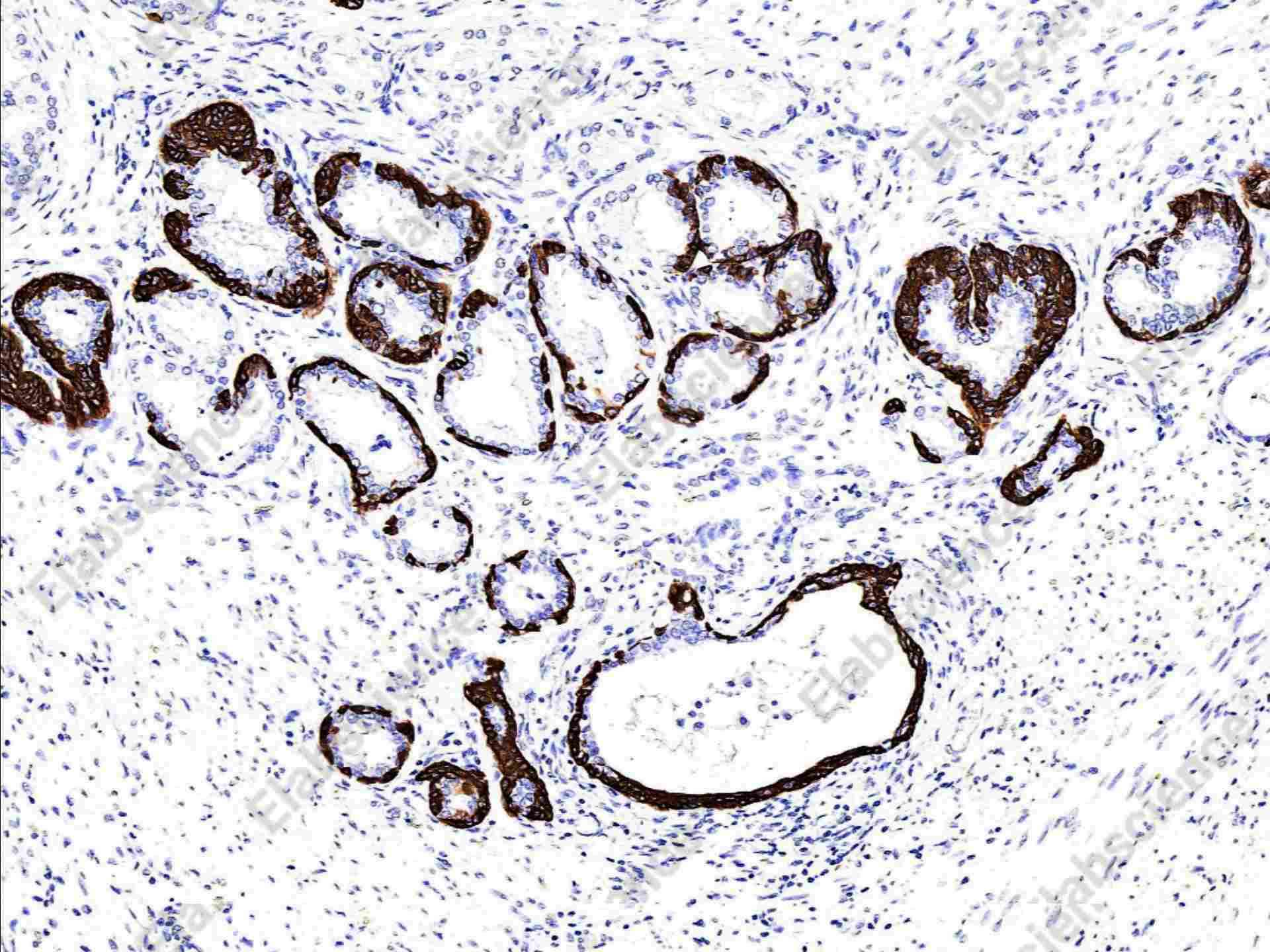 Recombinant Cytokeratin 5/KRT5 Monoclonal Antibody - 1
