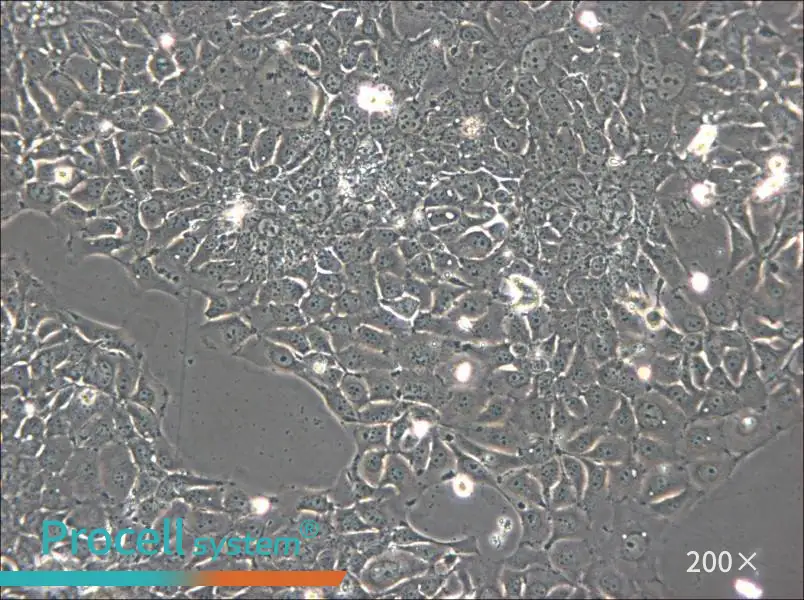 KYSE-140 Cell Complete Medium - 4