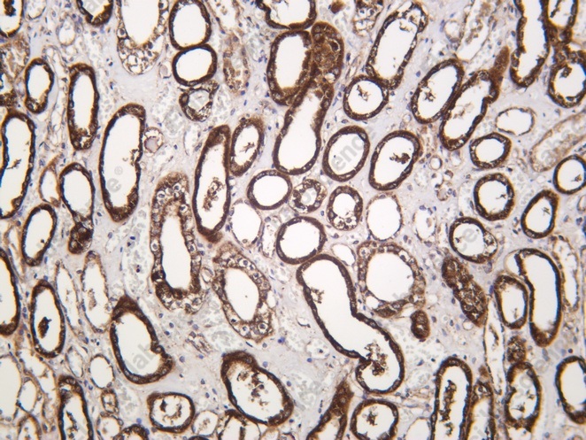 Recombinant GOT2 Monoclonal Antibody - 1