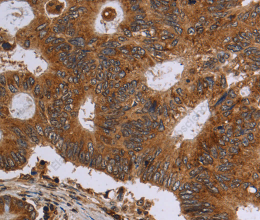 HSD17B4 Polyclonal Antibody - 2