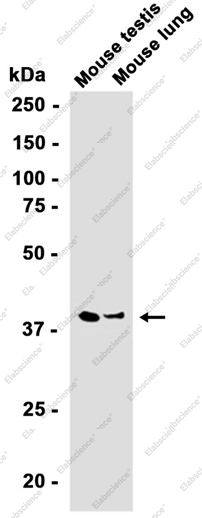 Recombinant PKA gamma (catalytic subunit) Monoclonal Antibody - 2