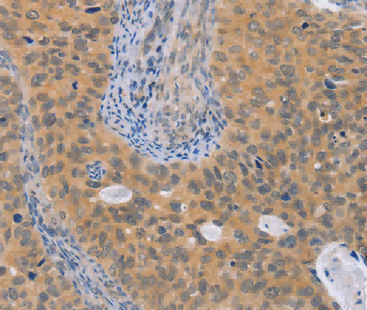 BRS3 Polyclonal Antibody - 3