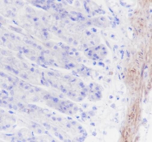 Recombinant Calponin 1 Monoclonal Antibody - small - 5