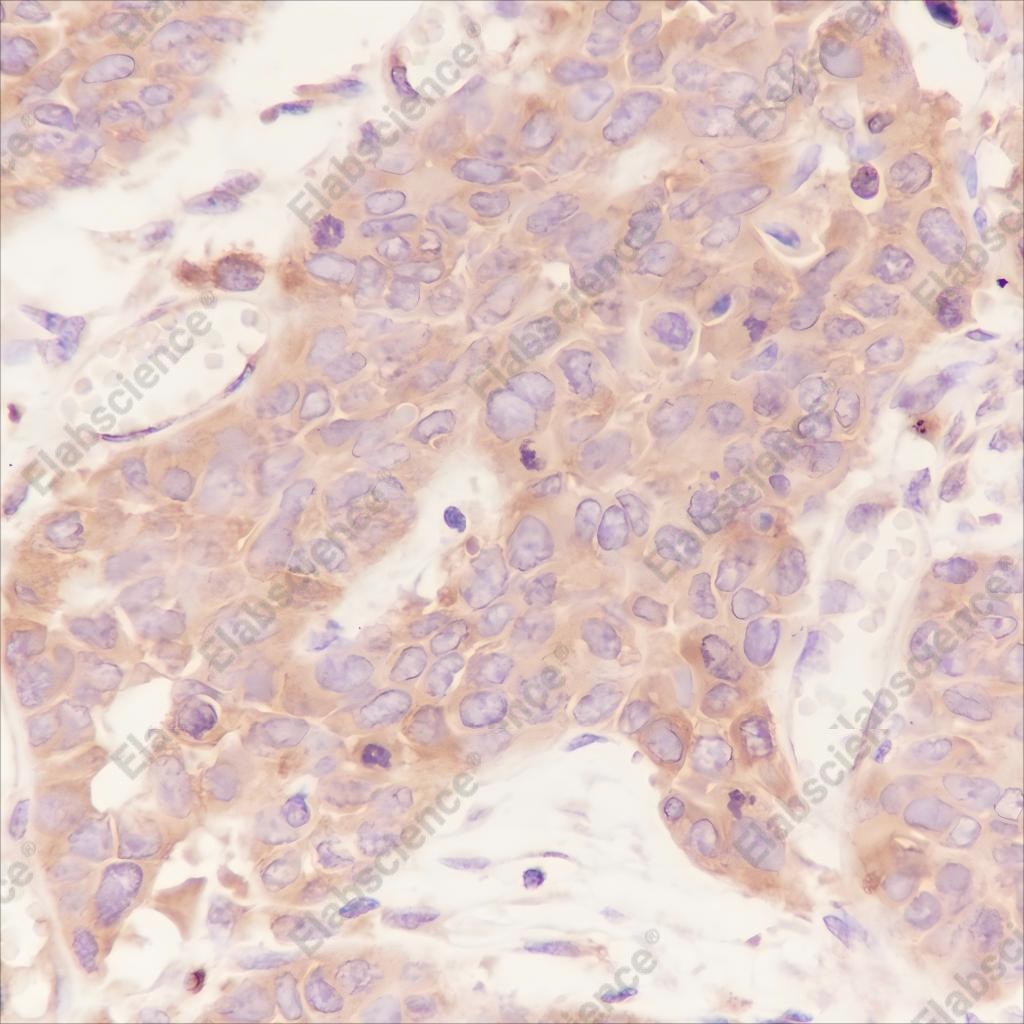 Recombinant LPCAT1 Monoclonal Antibody - 2